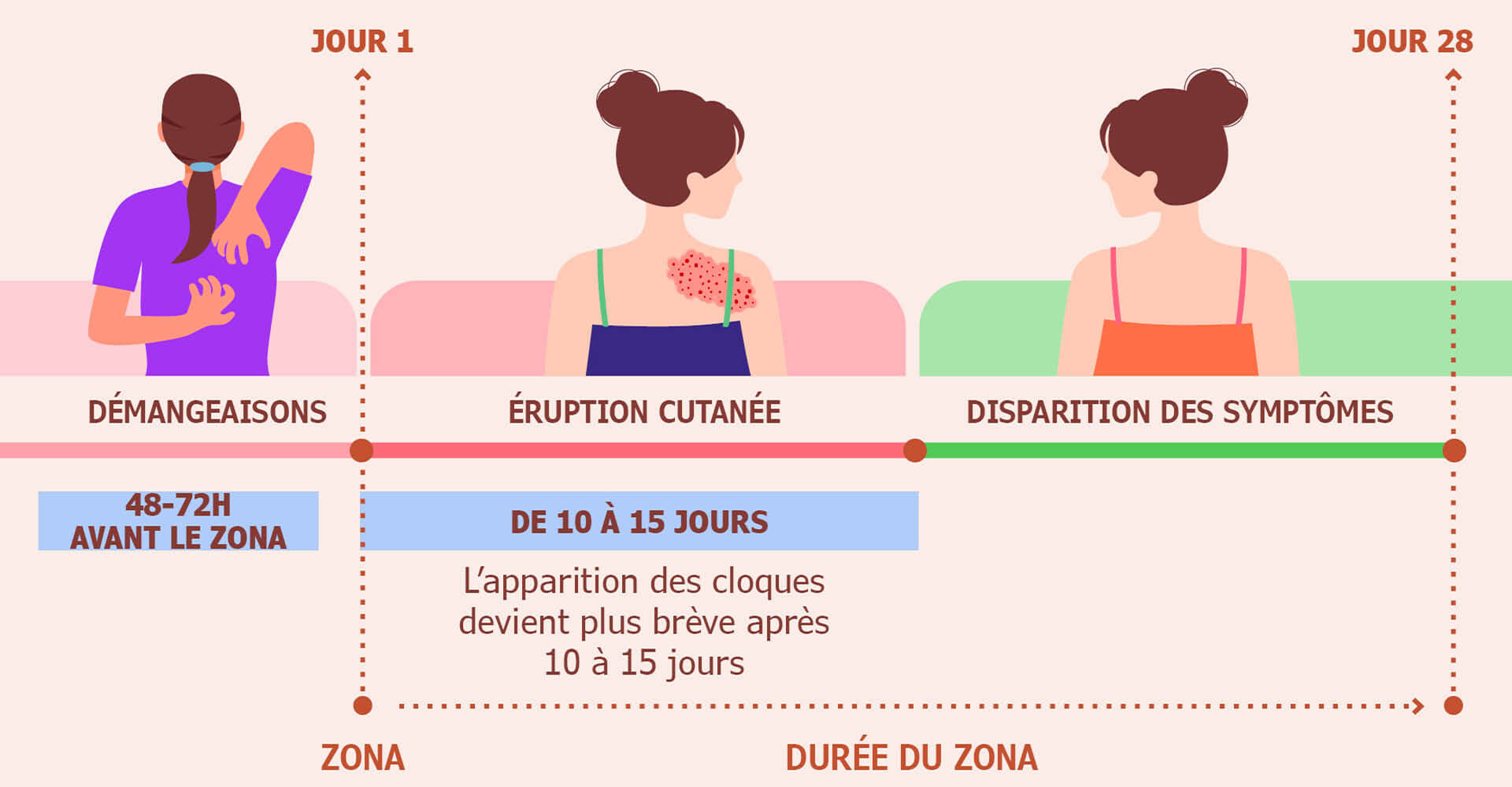 Trois images illustrant les différentes étapes du zona. Première image : femme se grattant l'épaule droite. Seconde image : femme présentant une éruption cutanée rouge et vésiculeuse sur l'épaule. Troisième image : femme avec une peau claire sur l'épaule.